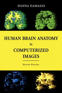 Human Brain Anatomy in Computerized Images