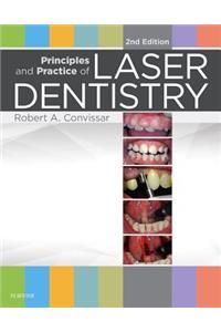 Principles and Practice of Laser Dentistry