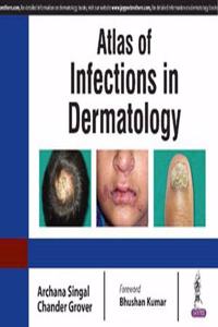 Atlas of Infections in Dermatology