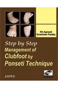 Step by Step Management of Clubfoot by Ponseti Technique (with DVD-ROM)