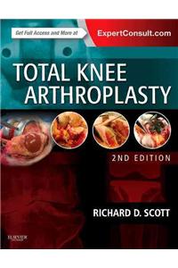 Total Knee Arthroplasty