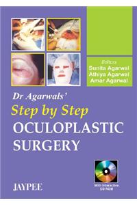 Dr. Agarwal's Step by Step Oculoplastic Surgery