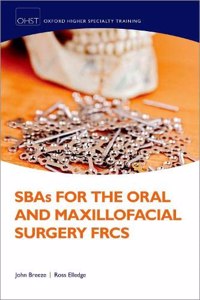 SBAs for the Oral and Maxillofacial Surgery FRCS