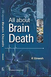All about Brain Death