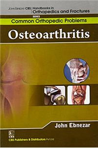 John Ebnezar CBS Handbooks in Orthopedics and Factures