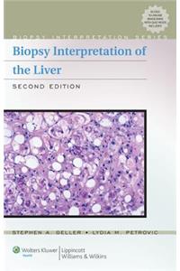 Biopsy Interpretation of the Liver