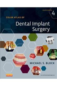 Color Atlas of Dental Implant Surgery