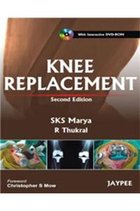 Knee Replacement [with DVD Rom]