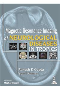 Magnetic Resonance Imaging of Neurological Diseases in Tropics