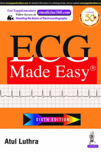 ECG Made Easy