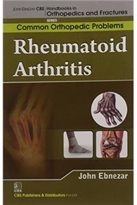 Rheumatoid Arthritis (Handbooks In Orthopedics And Fractures Series, Vol. 92-Common Orthopedic Problems )