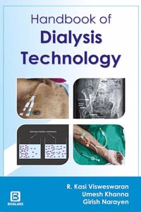 Handbook Of Dialysis Technology