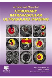 Atlas and Manual of Coronary Intravascular Ultrasound Imaging