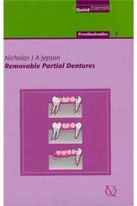 Removable Partial Dentures