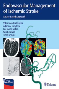 Endovascular Management of Ischemic Stroke