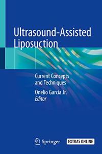 Ultrasound-Assisted Liposuction