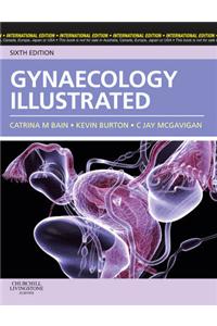Gynaecology Illustrated International Edition