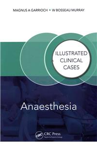 Anaesthesia