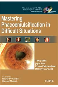 Mastering Phacoemulsification in Difficult Situations
