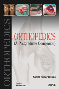 Orthopedics: A Postgraduate Companion