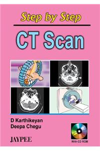 Step by Step CT Scan