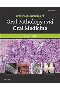 Cawson's Essentials of Oral Pathology and Oral Medicine