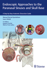 Endoscopic Approaches to the Paranasal Sinuses and Skull Base