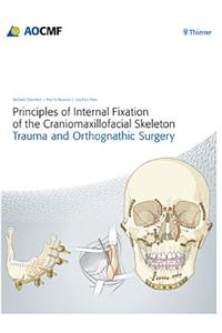 Principles of Internal Fixation of the Craniomaxillofacial Skeleton: Trauma and Orthognathic Surgery