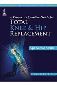 A Practical Operative Guide for Total Knee and Hip Replacement