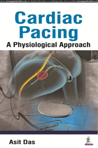 Cardiac Pacing A Physiological Approach