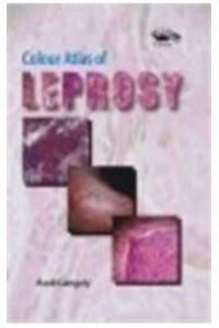 Colour Atlas Of Leprosy