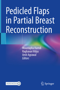 Pedicled Flaps in Partial Breast Reconstruction