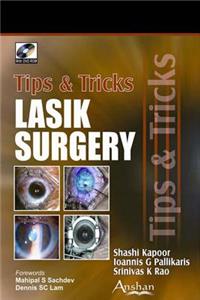 Lasik Surgery: Tips and Tricks