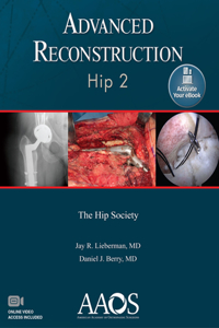 Advanced Reconstruction: Hip 2: Print + eBook with Multimedia