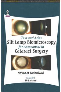 Text and Atlas: Slit Lamp Biomicroscopy for Assessment in Cataract Surgery