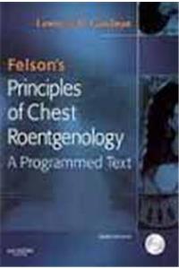 Felson's Principles of Chest Roentgenology Second Edition