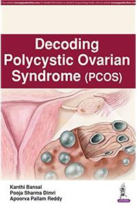Decoding Polycystic Ovarian Syndrome