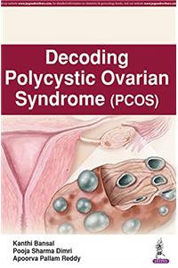 Decoding Polycystic Ovarian Syndrome