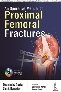 An Operative Manual of Proximal Femoral Fractures
