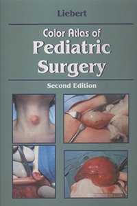 Color Atlas Of Pediatric Surgery, 2/E