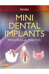 Mini Dental Implants