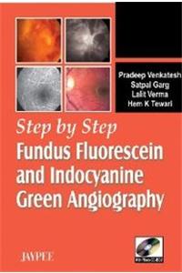 Step by Step (R) Fundus Fluorescein and Indocyanine Green Angiography