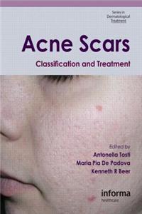 Acne Scars