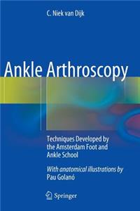 Ankle Arthroscopy