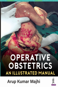 Operative Obstetrics