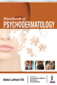Handbook of Psychodermatology
