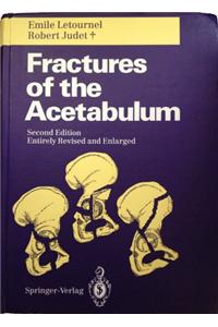 Fractures of the Acetabulum