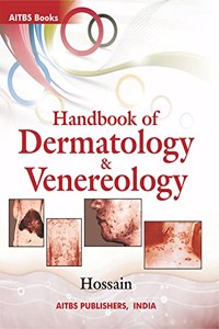 Handbook of Dermatology and Venereology