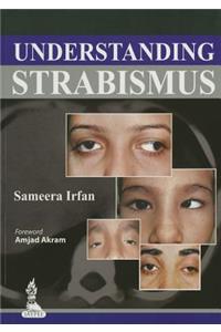 Understanding Strabismus