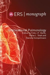Interventional Pulmonology: 78 (ERS Monograph)